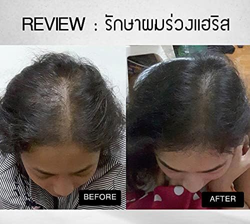 DHL tarafından Havılah Haırıtz Onarıcı Serum 30 ml Anti Saç Dökülmesi Saç Çıkma Regrow Hız Büyüme Tumtimshop tarafından [Ücretsiz
